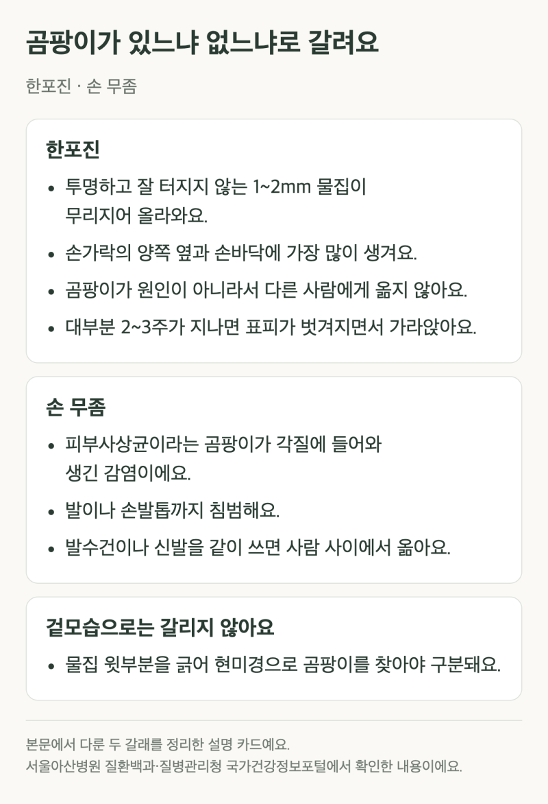 한포진 손 무좀 차이, 손가락 옆에 물집이 잡혔다면?