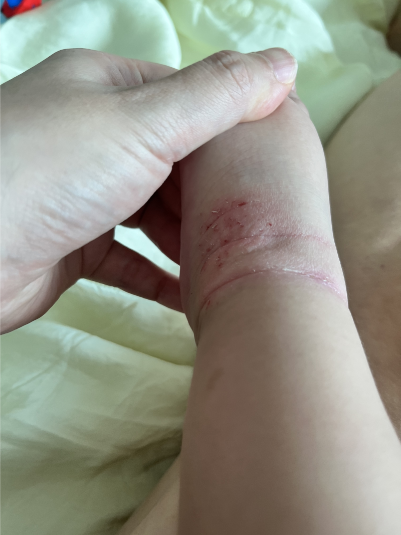 아기 보습제 비교, 제로이드 인텐시브 로션 MD vs 인트린직 로션 MD 사용 후기