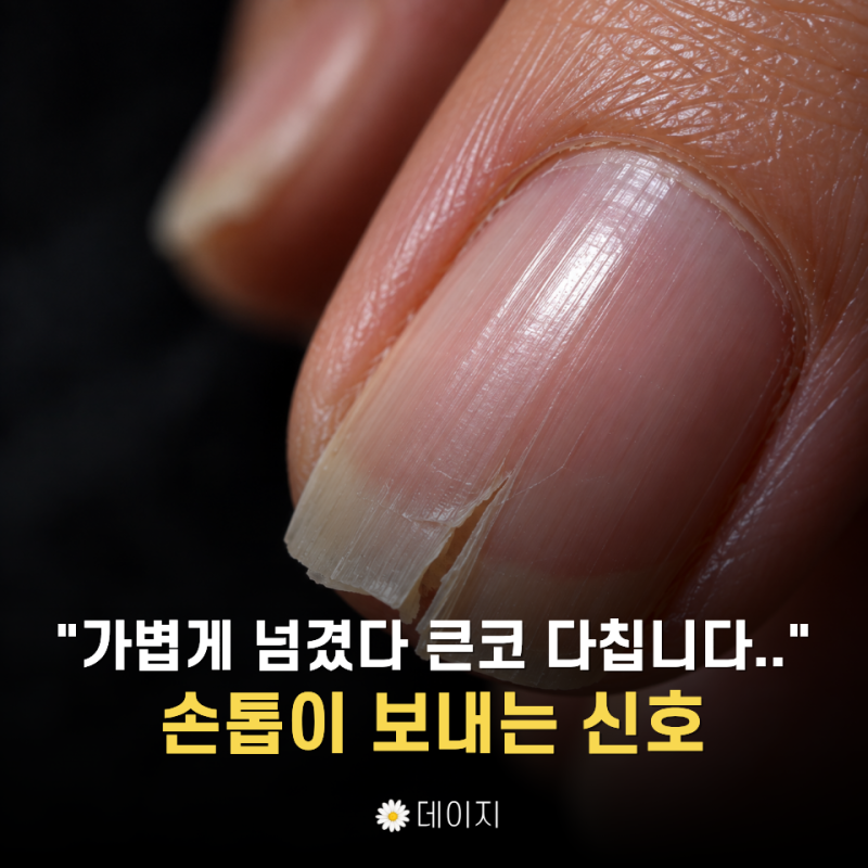 "손톱에서 신호가 옵니다" 그냥 넘기면 안 되는 손톱에 나타나는 증상 4가지