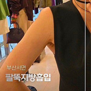 부산팔뚝지방흡입 두 달차 후기 다이어트와 민소매