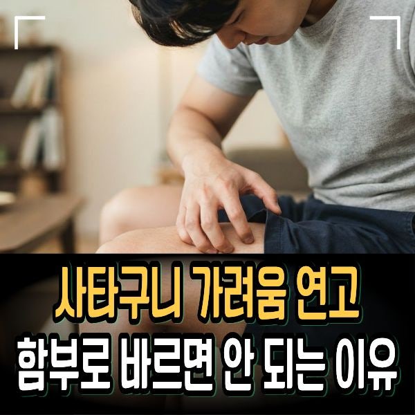 사타구니 가려움 연고 함부로 바르면 안 되는 이유 (완선 vs 습진 구분법)