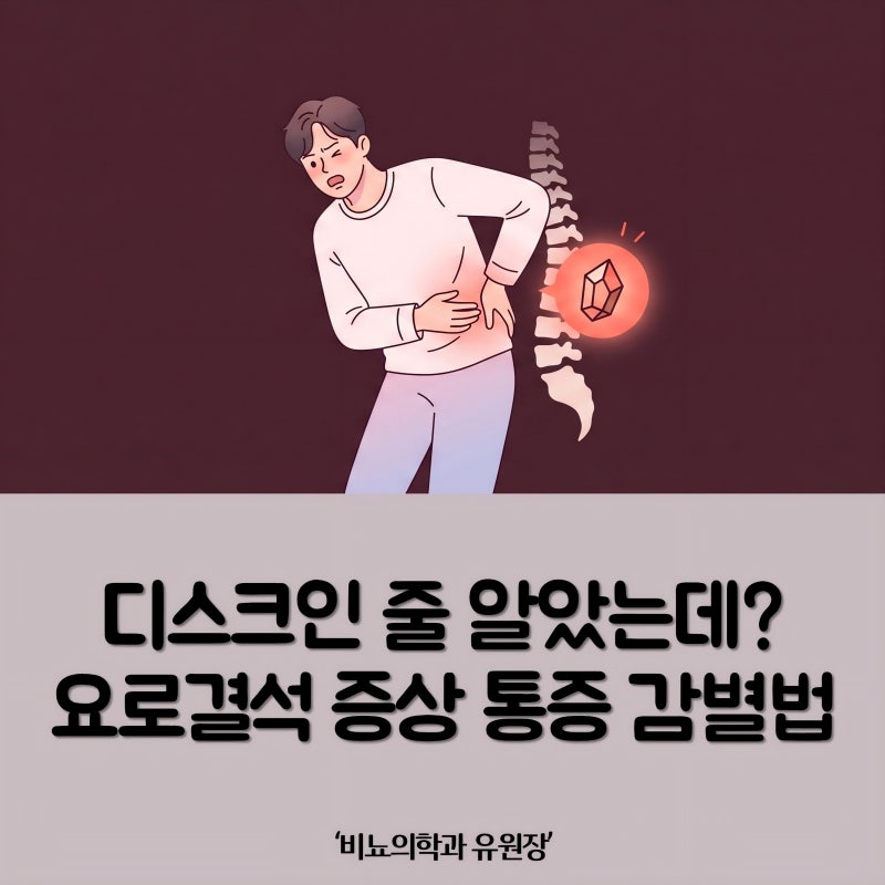 갑작스런 옆구리 통증, 요로결석 증상 3대 신호