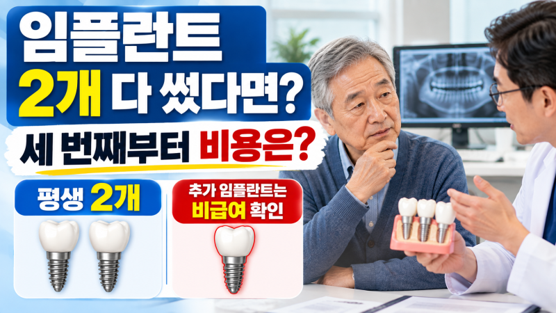 건강보험 임플란트 2개를 다 썼다면? 세 번째부터 비용은 어떻게 될까?