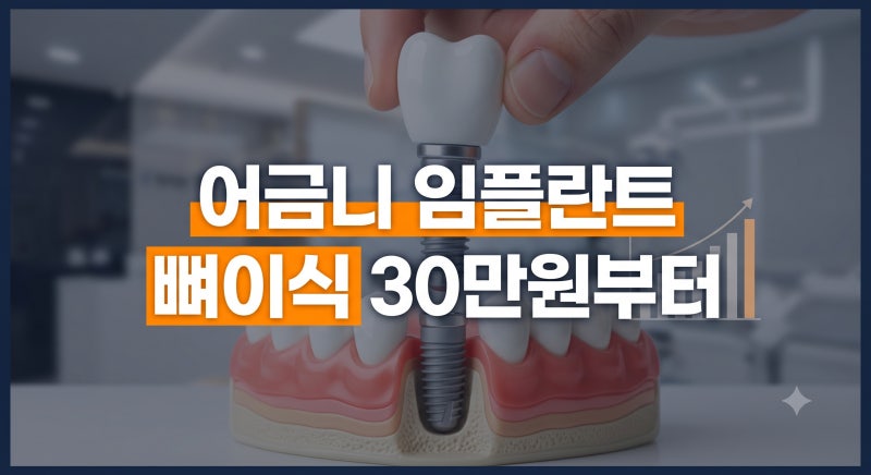 어금니 임플란트 뼈이식 비용 및 치료 과정과 회복기간 총정리