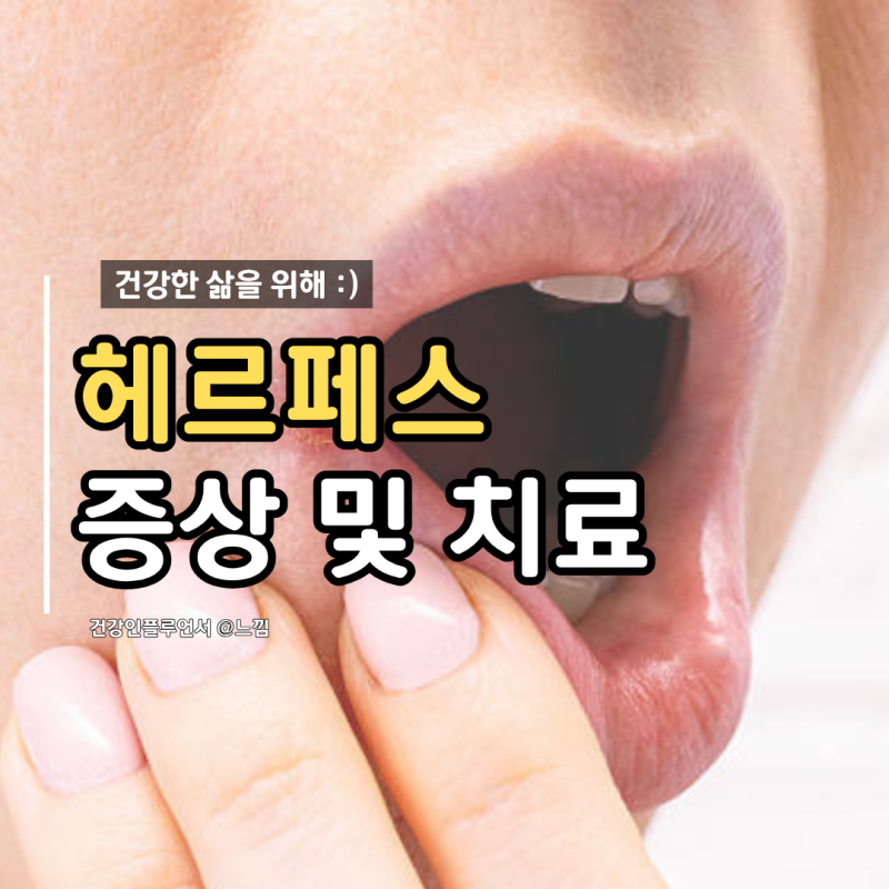 입술 헤르페스 물집 터뜨리면 안 되는 이유 (초기 대처법 총정리)
