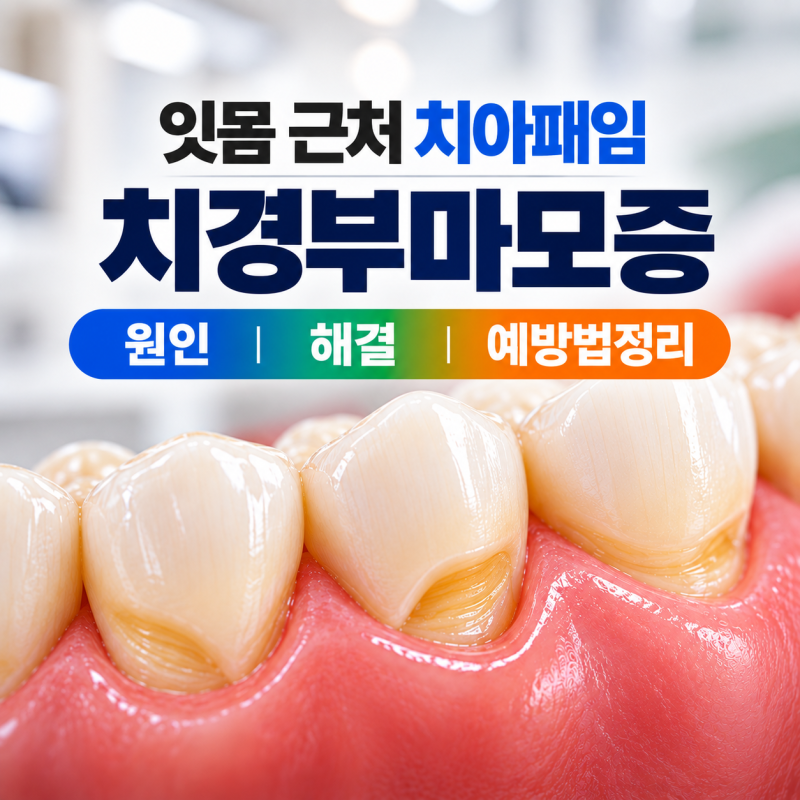 오산치과 잇몸패임,치아패임 치경부마모증 (원인,치료,예방) 정리