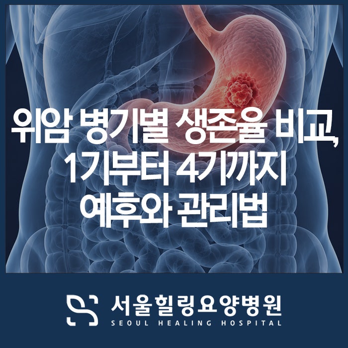 위암 병기별 생존율 비교, 1기부터 4기까지 수치로 보는 예후와 관리법