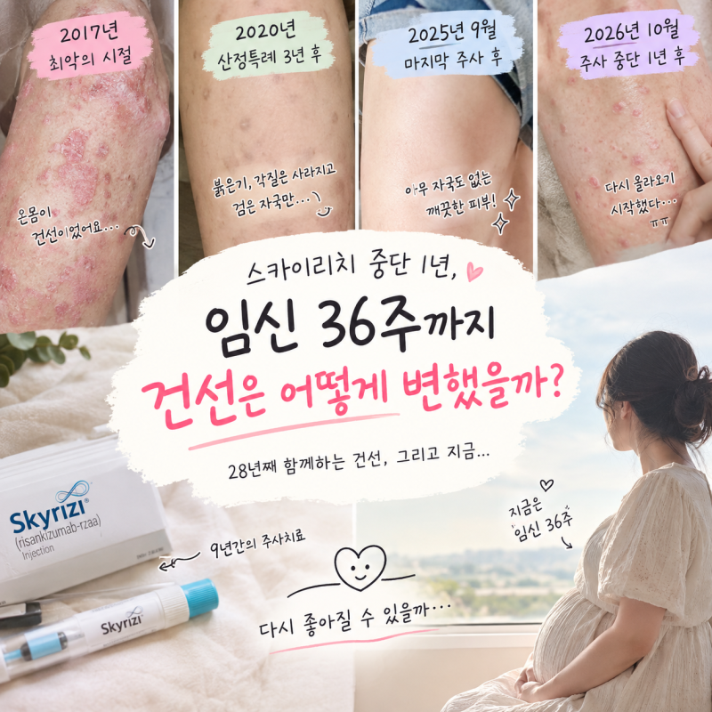 [건선피부 28년차] 임산부 산정특례 스카이리치 중단 후기