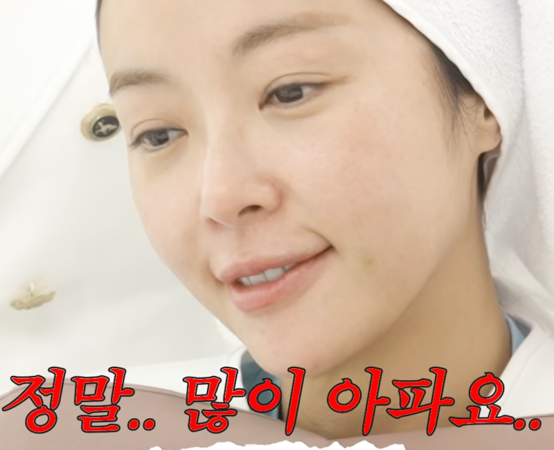 황정음, "쌍꺼풀만 4번…" 더 예뻐지려다 다시 예전 얼굴로