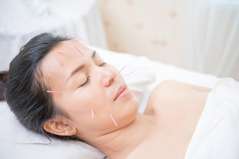 안면신경마비 구안와사 - 스테로이드 치료 꼭 필요할까? 침치료와 병행은? [부천 상동 서울한....