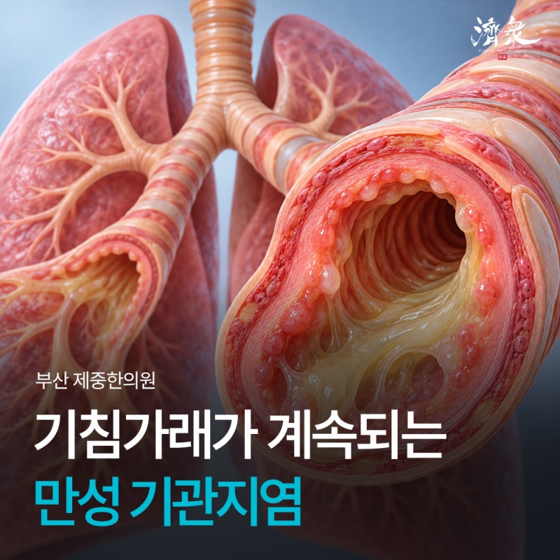 만성 기관지염, 감기약을 먹어도 기침가래가 계속되는 이유