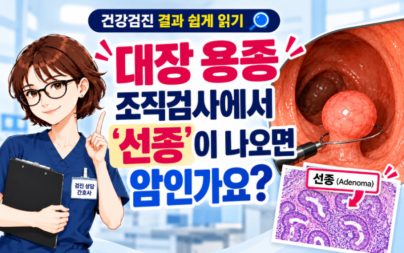 건강검진 대장 용종 조직검사에서 ‘선종’이 나오면 암인가요 ?