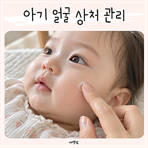 아기 얼굴 손톱에 긁힌 상처, 연고 치료로 흉터 없이 나을까