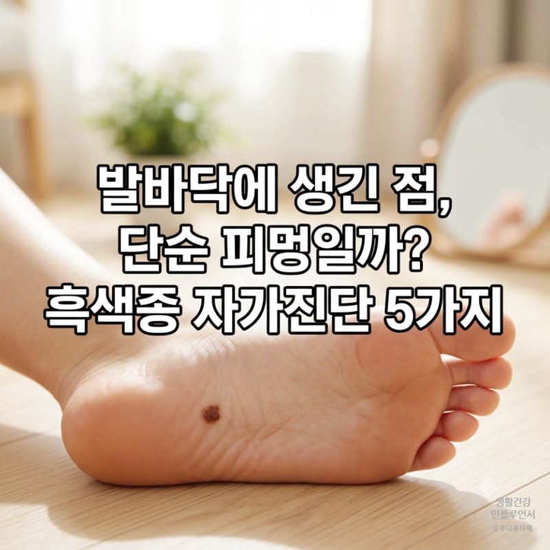 발바닥 점, 그냥 뒀다가 위험? 흑색종 구별하는 ABCDE 자가진단법