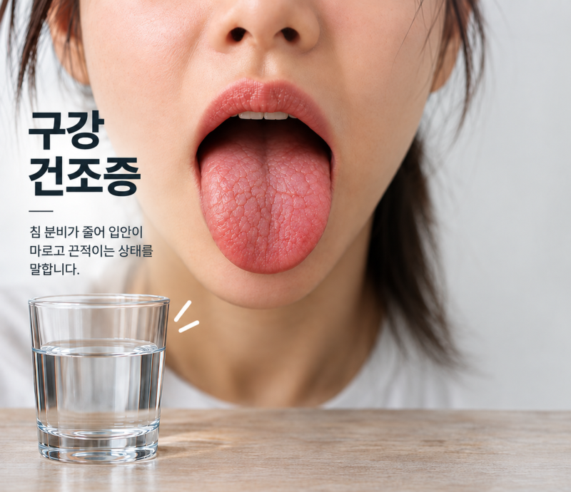 아침마다 입안이 마르고 입냄새가 계속 나는 이유는? / 강남레옹치과