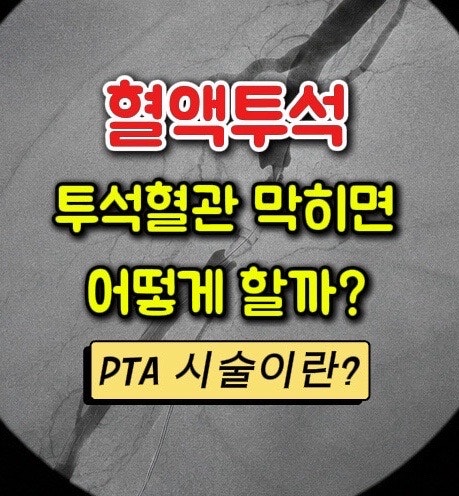[혈액투석]투석혈관이 좁아졌을 때 나타나는 증상 | 혈관이 막히면 어떤 시술을 할까?