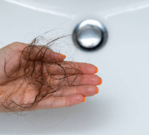 PCOS 안드로겐 탈모 극복: 이노시톨과 쏘팔메토 병용 효과 및 복용법 총정리