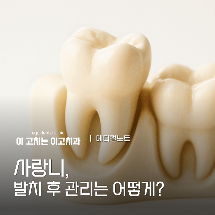 성산구 사랑니 발치 후, 식사·양치·운동은 어떻게 관리할까요?