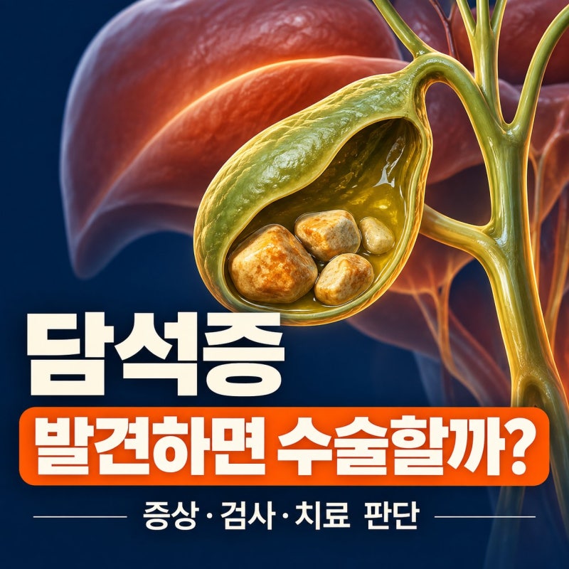 담석증 증상·검사와 수술, 발견하면 바로 치료해야 할까요?