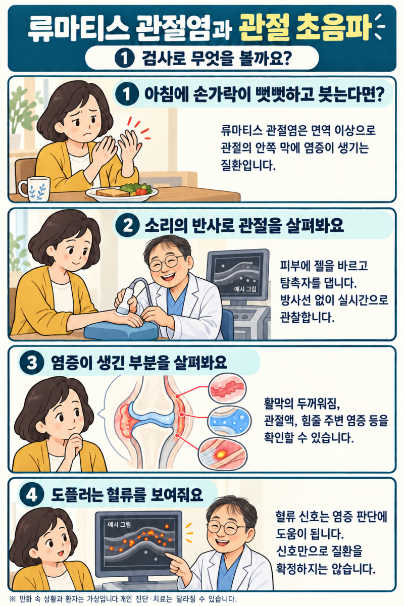 류마티스 관절염, 관절 초음파로 무엇을 알 수 있을까요? 진단과 치료에서의 역할