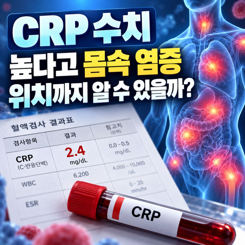 CRP 수치, 높다고 몸속 염증 위치까지 알 수 있을까?