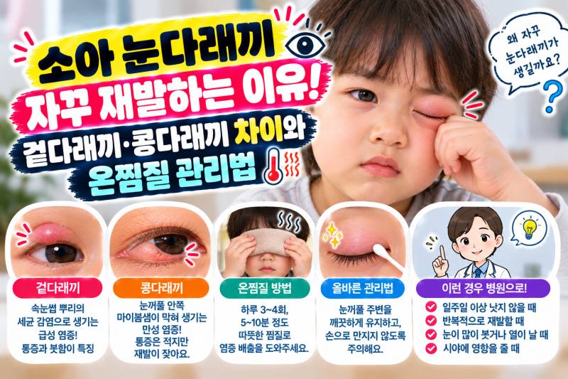 소아 눈다래끼 자꾸 재발하는 이유! 겉다래끼·콩다래끼 차이와 온찜질 관리법
