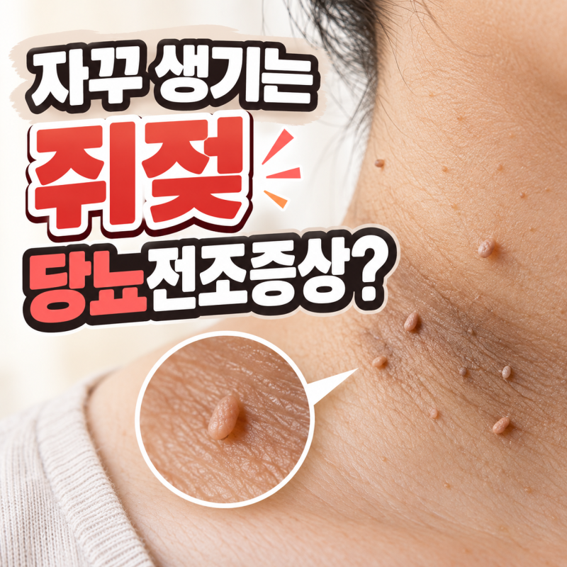 자꾸 생기는 쥐젖, 그냥 넘기면 안 되는 당뇨전조증상 시그널