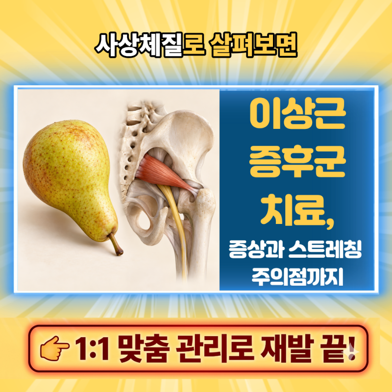 이상근증후군 치료, 증상과 스트레칭 주의점까지
