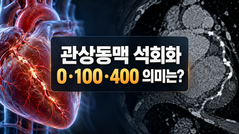 관상동맥 석회화 수치 0·100·400, 검사 결과는 어떻게 볼까?