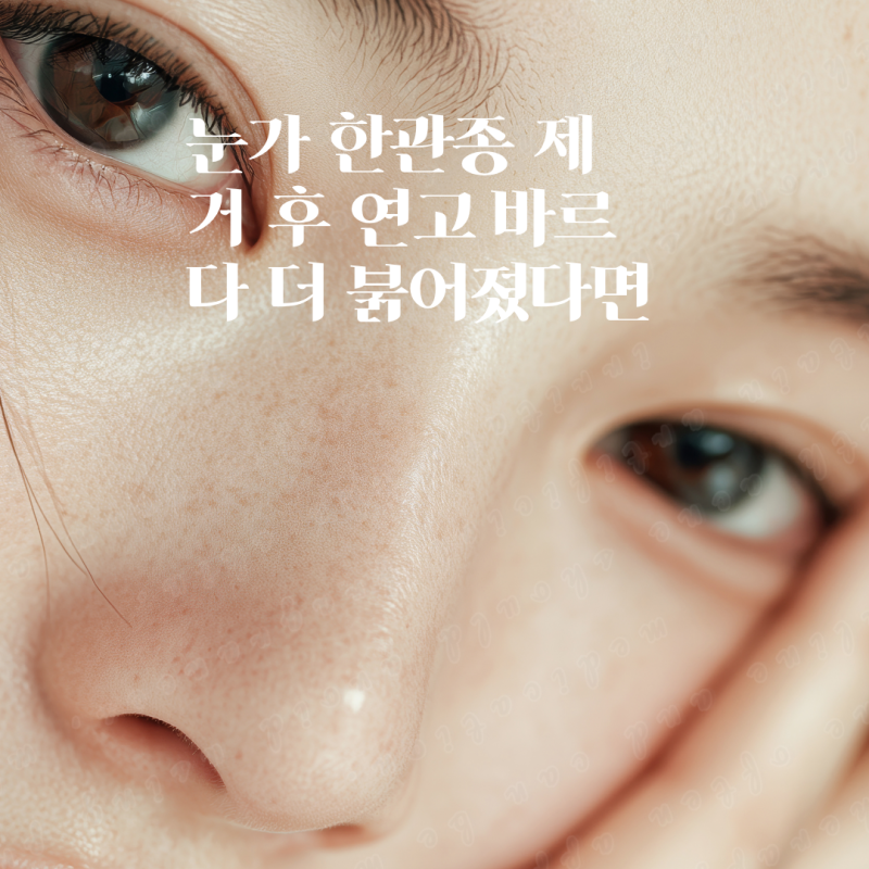 눈가 한관종 제거 후 연고 바르다 더 붉어졌다면