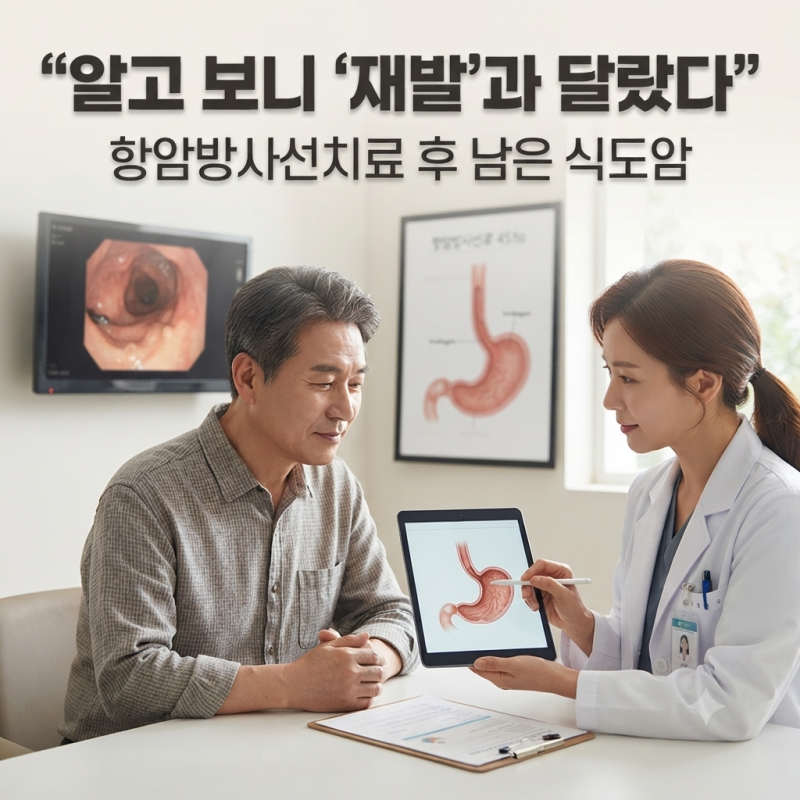 알고 보니 ‘재발’과 달랐다｜항암방사선치료 후 남은 식도암, 왜 중요한가?