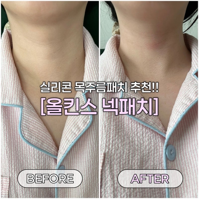 목주름팩 올킨스 실리콘 넥테이프, 15번 쓰는 주름패치 솔직후기