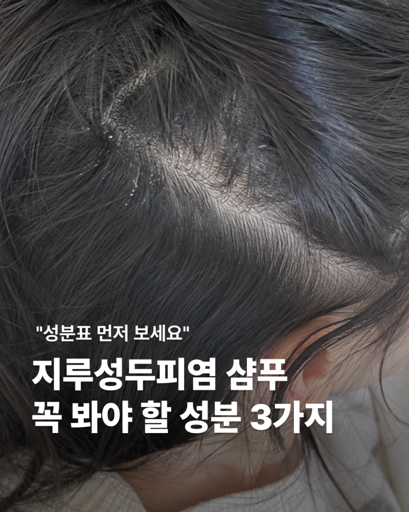 지루성두피염 샴푸 사기 전에 성분표부터 확인하세요