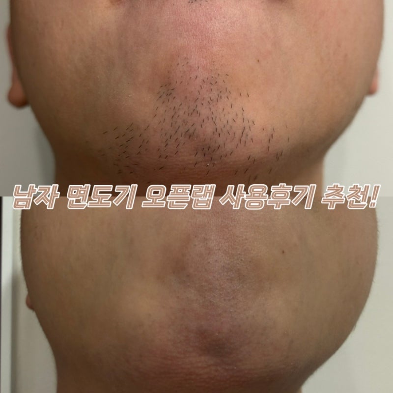 남자 면도기 추천, 굵은 수염 오픈랩 7중날 면도기 사용 후기