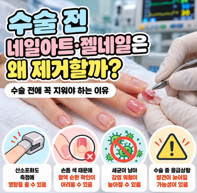 수술 전 네일아트·젤네일은 왜 제거할까? 수술 전에 꼭 지워야 하는 이유