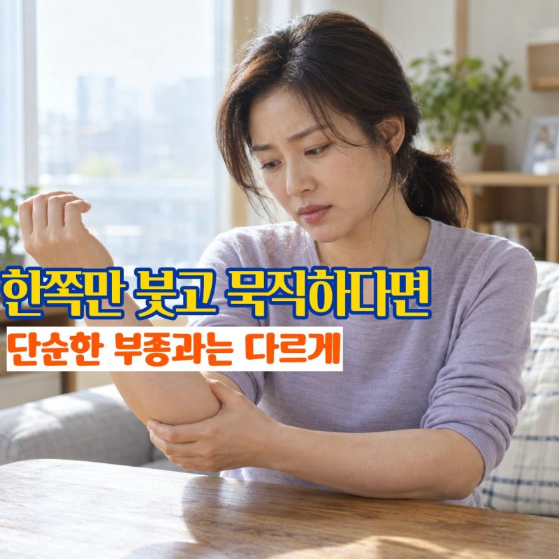 림프부종 한쪽 팔이나 다리가 붓고 묵직할 때 림프순환과 함께 보는 원인