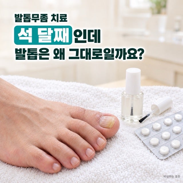 발톱무좀 치료 석 달째인데… 발톱은 왜 그대로일까요?