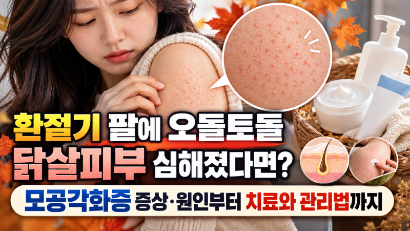 환절기 팔에 오돌토돌 닭살피부 심해졌다면? 모공각화증 증상·원인부터 치료와 관리법까지