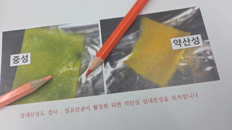 자궁경부이형성증 치료 단계 CIN1 CIN2 CIN3 이렇게 재발 회복 중요합니다