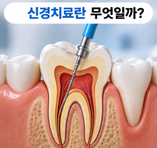 신경치료 비용 얼마 나올까? 건강보험 적용부터 실비 청구까지
