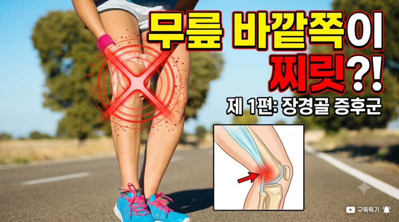 달릴 때 무릎 바깥쪽 통증? 러너를 괴롭히는 '장경골 증후군' 원인부터 3분 예방법까지!