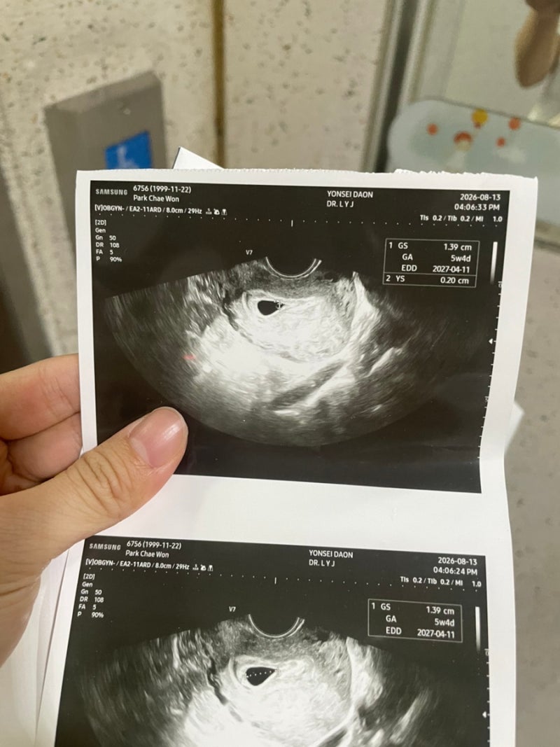 임신 초기 4-5주차 기록 (자연임신 초산모 / 첫 확인 / 주수 밀림 /피비침)