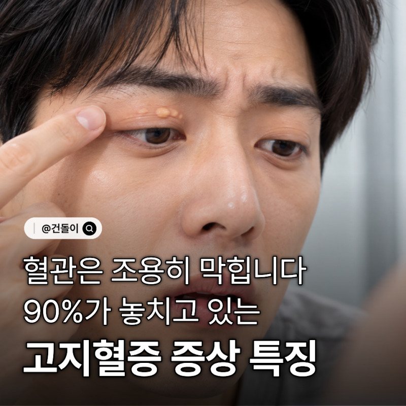 "혈관은 조용히 막힙니다.." 90%가 놓치고 있는 고지혈증 증상