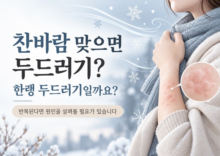 찬바람을 맞으면 두드러기가 올라와요, 한랭 두드러기일까요?