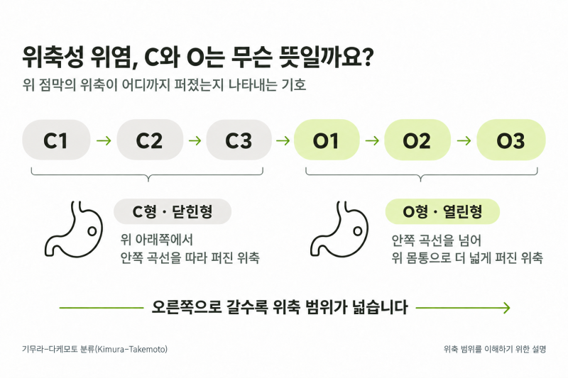 위내시경에 '위축성 위염'이 나왔습니다 — 위암 전 단계일까요?