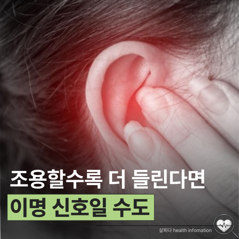 귀에서 삐 소리 난다면 이명일까? 피곤해서 그런 줄만 알았는데...
