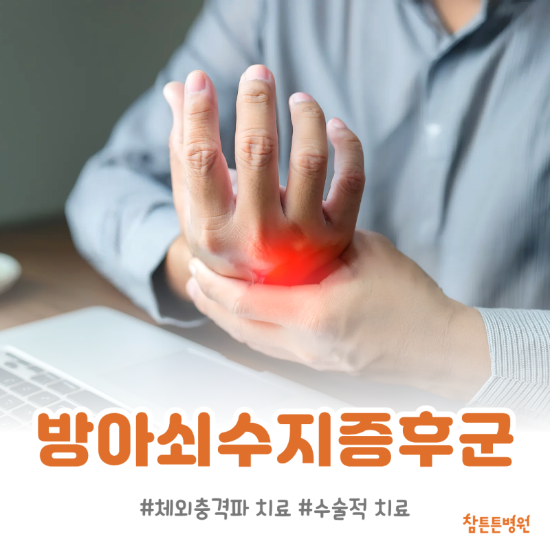 대구 손가락 병원 방아쇠수지증후군 좋아지는 방법은?