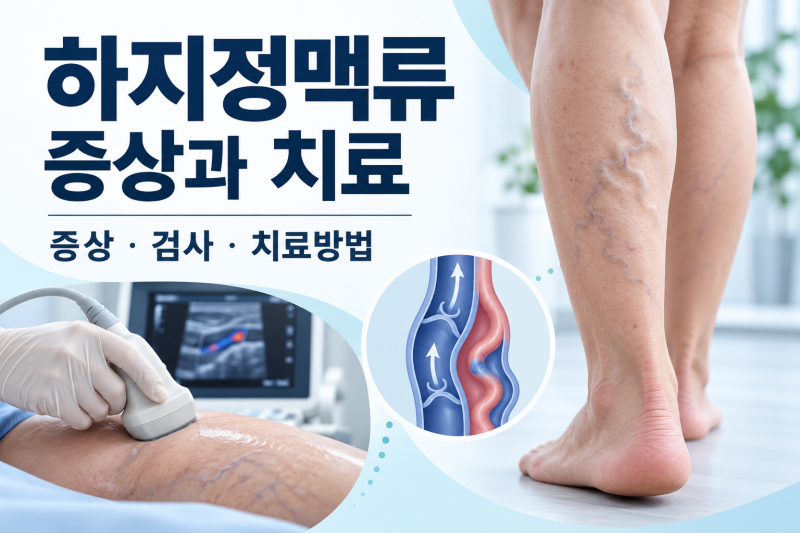 하지정맥류 증상과 치료, 수술방법·압박스타킹·병원 선택까지