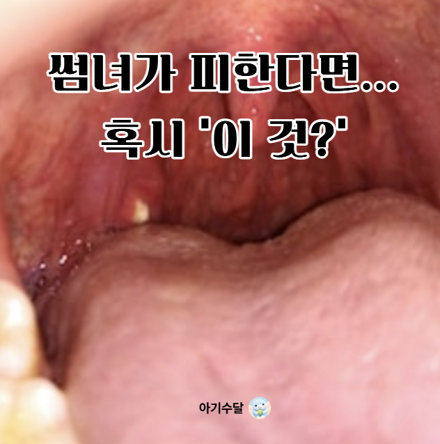 "너 입냄새 나는거 같아"들어본사람 주목! '편도결석'일지도