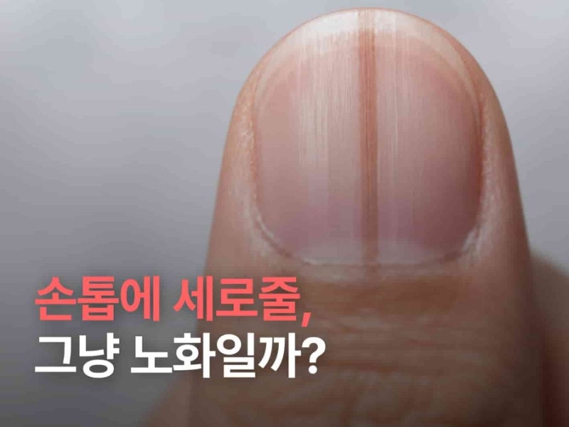 지금 바로 손톱을 보세요! 세로줄이 보인다면 이 영양소가 부족하다는 뜻